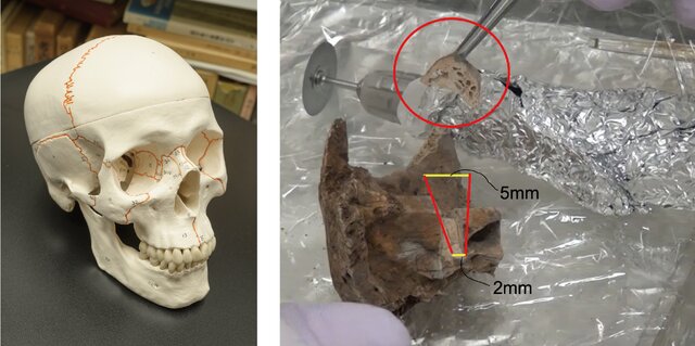 頭蓋からDNAを採取。耳の後ろに、高い確率で採取できる場所が見つかった。